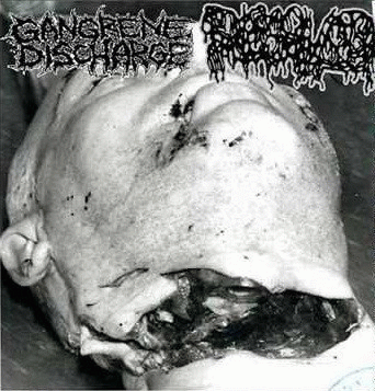 Gangrene Discharge : Gangrene Discharge - Dissolved